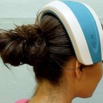 przeszczep włosów cena