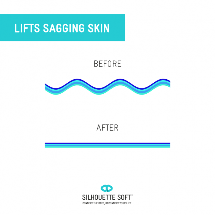 przeszczep włosów katowice, przeszczep włosów cena