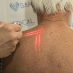 Stymulacja nerwu błędnego laserem